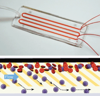 Image: The microfluidic chip works by mimicking the physiological process of 'cell rolling' where patterns of adhesive molecules are used to draw out neutrophils (blue) from a stream of blood (red) into a parallel buffer stream as shown in the bottom panel (Photo courtesy of Suman Bose and Rohit Karnik).